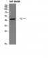 Corticotropin-releasing factor receptor 2 Polyclonal Antibody