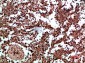 Annexin I Polyclonal Antibody