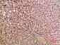 CKR-5 Polyclonal Antibody