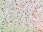 ASIC1 Polyclonal Antibody