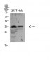 SOCS-2 Polyclonal Antibody
