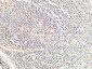 Endoglin Polyclonal Antibody