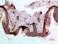 Galectin-1 Polyclonal Antibody