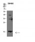 Galectin-1 Polyclonal Antibody