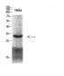 Cdk6 Polyclonal Antibody
