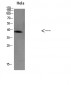 TIM-1 Polyclonal Antibody