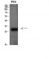 PD-L2 Polyclonal Antibody