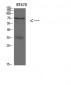 Cytokeratin 4 Polyclonal Antibody