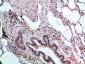 ASCL1 Polyclonal Antibody