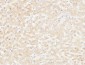 ANG I Polyclonal Antibody