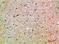OSM Polyclonal Antibody