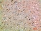 OSM Polyclonal Antibody