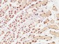 pS2 Polyclonal Antibody