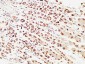 pS2 Polyclonal Antibody