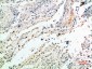 Versican Polyclonal Antibody