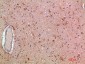 MLL Polyclonal Antibody