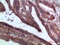 IL-1F7 Polyclonal Antibody