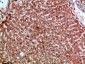 MIP-3α Polyclonal Antibody
