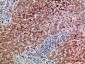 BMP-9 Polyclonal Antibody
