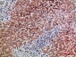 BMP-9 Polyclonal Antibody