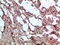 BMP-9 Polyclonal Antibody