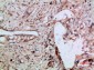 ENA-78 Polyclonal Antibody