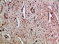 ENA-78 Polyclonal Antibody