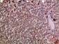 SDF-1 Polyclonal Antibody