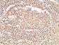 HDGF Polyclonal Antibody