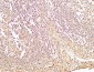 HDGF Polyclonal Antibody