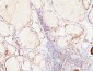 Thyroglobulin Polyclonal Antibody