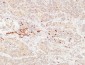 Thyroglobulin Polyclonal Antibody