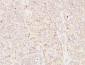 Thyroglobulin Polyclonal Antibody