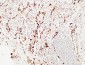 Napsin A Polyclonal Antibody