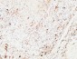 Napsin A Polyclonal Antibody