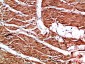 TTN Polyclonal Antibody