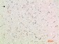 MIG Polyclonal Antibody