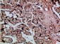 Cystatin B Polyclonal Antibody