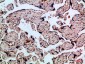 Flt-4 Polyclonal Antibody