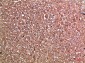 Haptoglobin Polyclonal Antibody