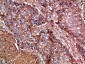 Haptoglobin Polyclonal Antibody