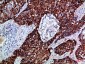 EphB3 Polyclonal Antibody