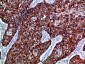 EphB3 Polyclonal Antibody