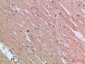 Cytoglobin Polyclonal Antibody