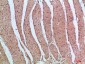 PI 3-Kinase p85β Polyclonal Antibody