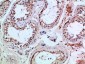 PI 3-Kinase p85β Polyclonal Antibody