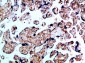 BMPR-IB Polyclonal Antibody