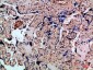 IL-8RA Polyclonal Antibody