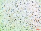 Frizzled-4 Polyclonal Antibody