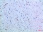 IL-15 Polyclonal Antibody